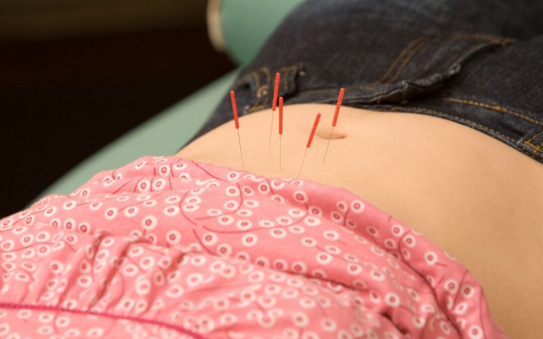 Acupuncture | A gift of peace and wellness to ourselves